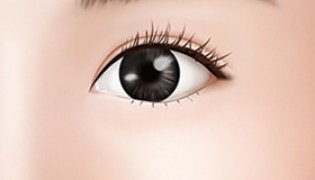 Lower Eyelid Fat Removal (Remove fat in the lower eyelid)