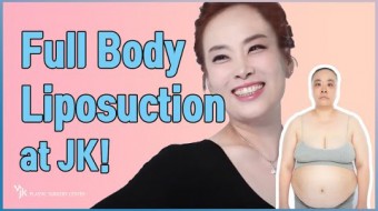 [Liposuction] Full Body Lipo and Facial Contouring