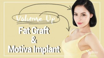 [Breast & Face] Motiva Implants & Fat Grafting