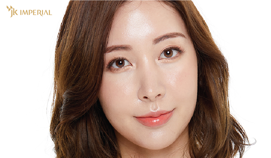 phương pháp mở góc mắt