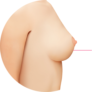 Normal Breast